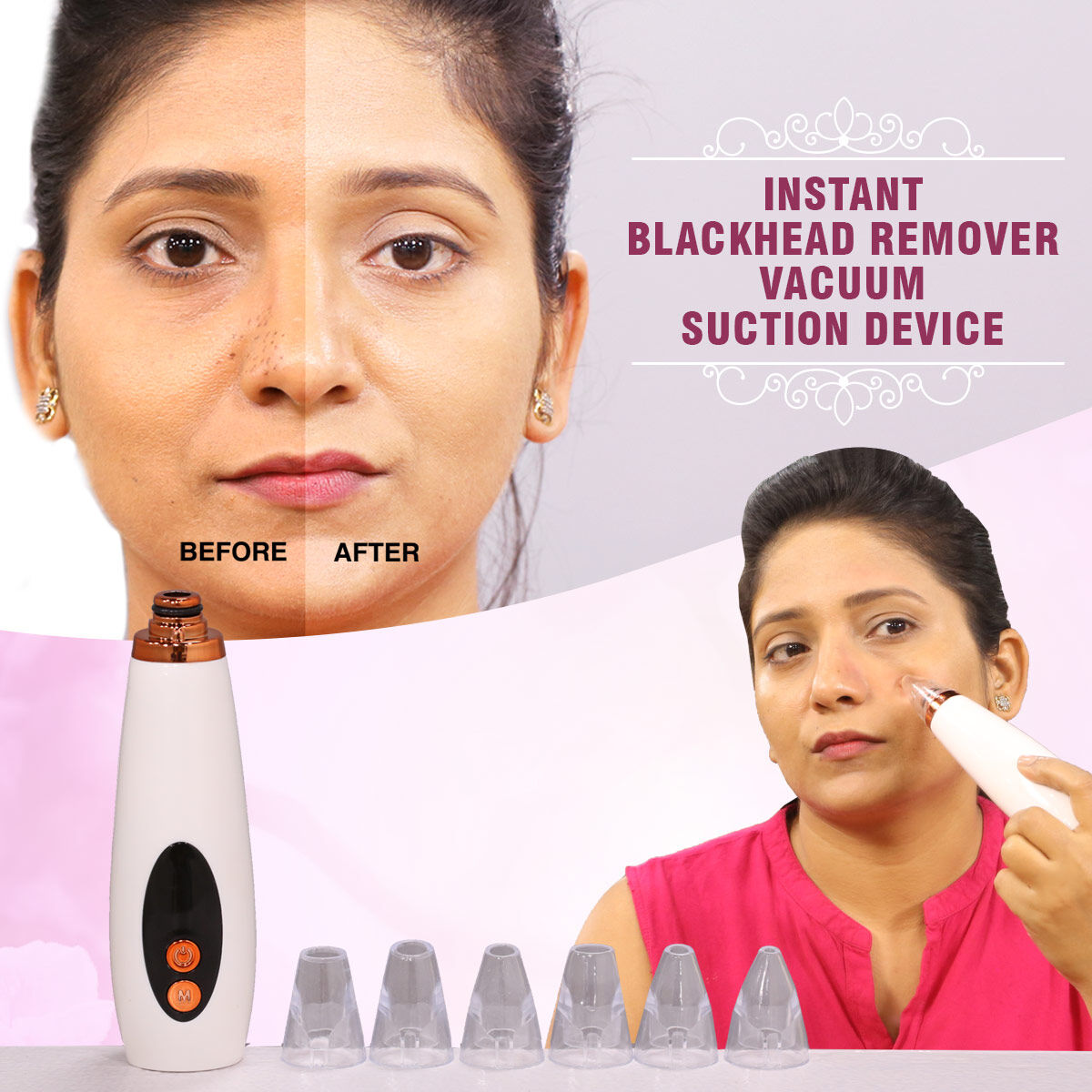"GlowSkin™ Portable Blackhead Remover"